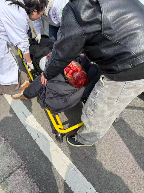 这还能活嘛 #车祸这还能活嘛 #车祸