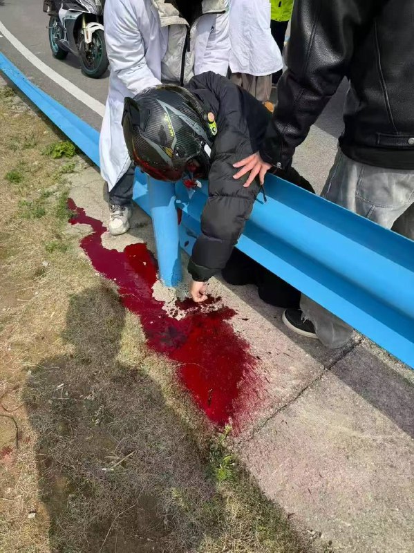 这还能活嘛 #车祸这还能活嘛 #车祸