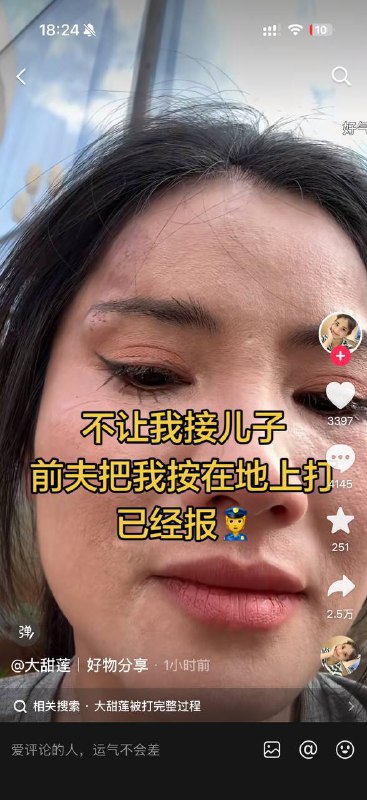 海南大甜莲接孩子被前夫暴打海南大甜莲接孩子被前夫暴打