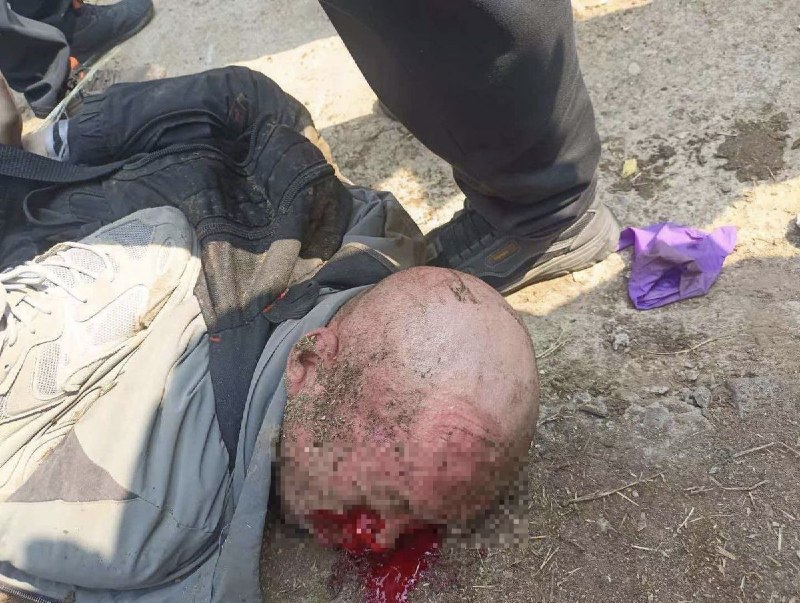 【血腥警告】网友投稿