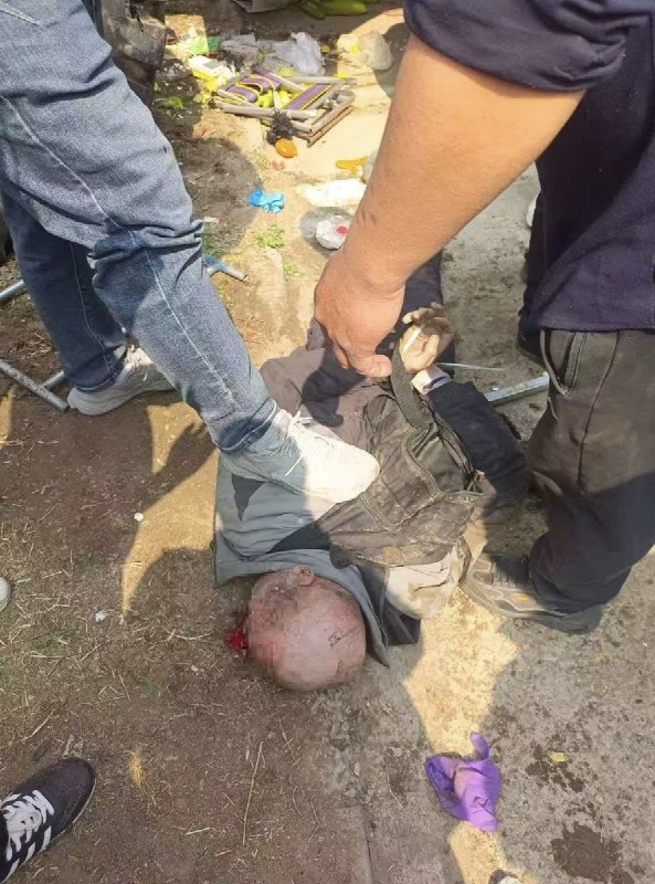 【血腥警告】网友投稿