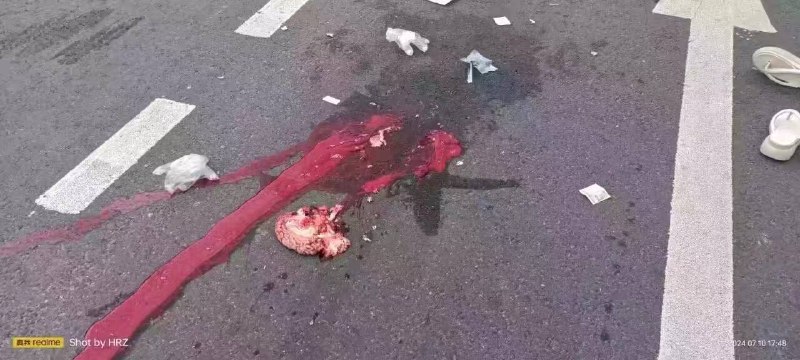 7月10日下午5点 四川南充南部县大润发旁边发生车祸，妈妈开电动车带8岁女儿被碾压 系大巴车违规变道，女儿当场死亡，脑浆都出来了，妈妈哭晕了过去 #车祸 #血腥﻿7月10日下午5点 四川南充南部县大润发旁边发生车祸，妈妈开电动车带8岁女儿被碾压 系大巴车违规变道，女儿当场死亡，脑浆都出来了，妈妈哭晕了过去 #车祸 #血腥