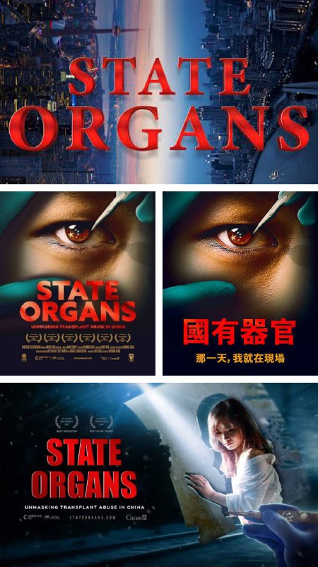 粉红们能不能把器官献给习主席？墙国失踪的学生，尸首被掏空器官，出现在荒郊野岭，或者直接被火化就地焚烧，就这样被共产党书记换了器官，或者被当成统战工具，免费送给普京们