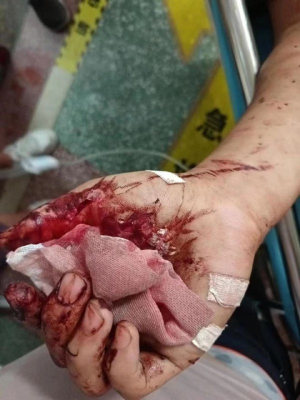 7.27河南省南阳市镇平县万德隆金街二楼砍人事件，当地公安不作为，至今没有解决 #刀仔🔪7.27河南省南阳市镇平县万德隆金街二楼砍人事件，当地公安不作为，至今没有解决 #刀仔🔪