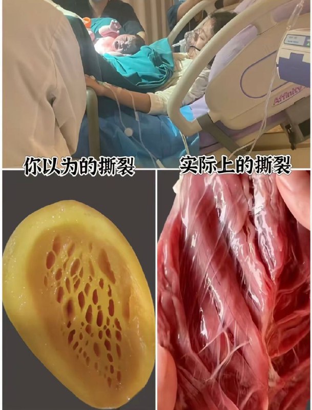 #保罗在美国 妻子大出血被怼脸拍 ，拿老婆博流量 #网红翻车保罗在美国