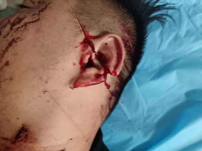 7.27河南省南阳市镇平县万德隆金街二楼砍人事件，当地公安不作为，至今没有解决 #刀仔🔪7.27河南省南阳市镇平县万德隆金街二楼砍人事件，当地公安不作为，至今没有解决 #刀仔🔪