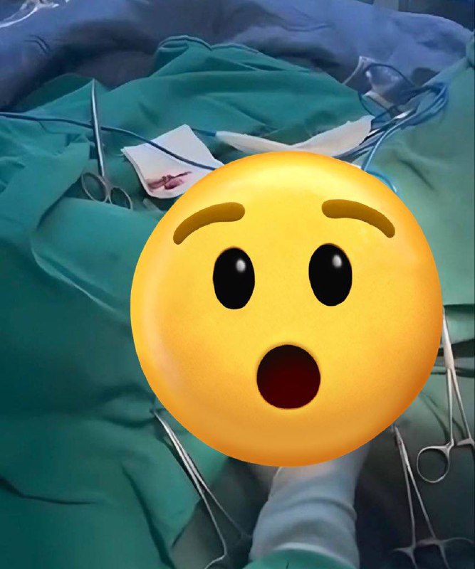 ⚠️ 离大谱了！2月2日，陕西中医药大学附属医院妇二科搞“内部培训”，结果竟然直接在（微信视频号）上直播妇科手术！隐私全光！ 视频里清晰展示了女性患者的私密部位，长达4分钟！🫣 🫣#吃瓜 #直播 #妇科手术⚠️ 离大谱了！2月2日，陕西中医药大学附属医院妇二科搞“内部培训”，结果竟然直接在（微信视频号）上直播妇科手术！隐私全光！ 视频里清晰展示了女性患者的私密部位，长达4分钟！🫣 🫣#吃瓜 #直播 #妇科手术