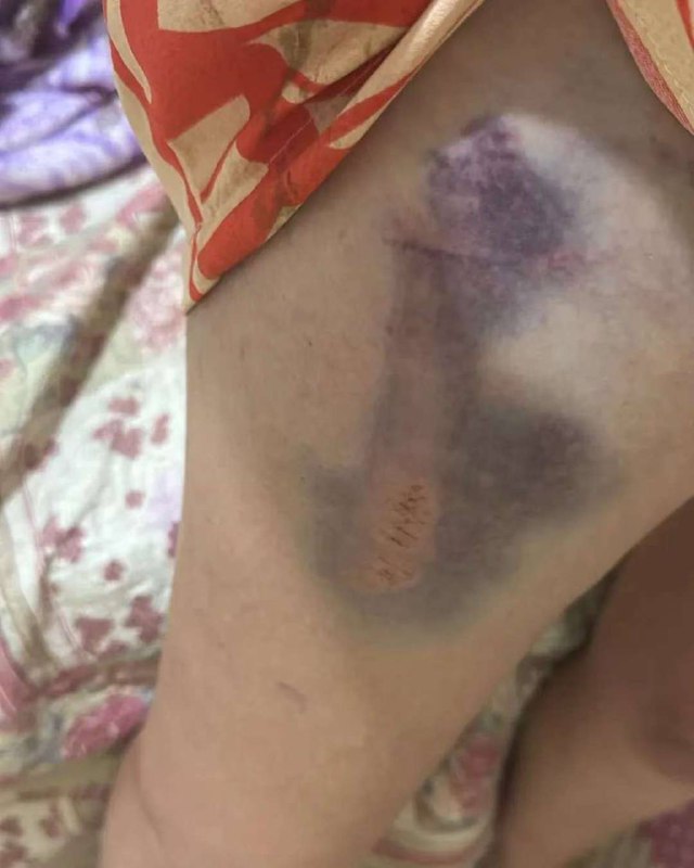 #洋妞 骑马 被 #马 踢飞 🐴#洋妞 骑马 被 #马 踢飞 🐴