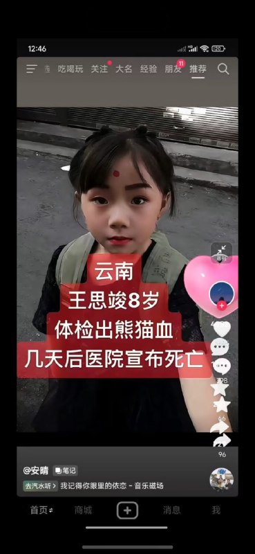 国有器官