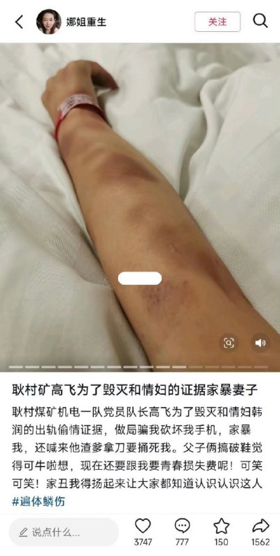 机智！丈夫婚内出轨，妻子把老公和小三的信息曝光，丈夫把妻子告上了法庭，最后妻子败诉，法院判决连续向老公和小三公开道歉15天！但她的道歉视频却暗藏“反击”，表面表态“我认错，服从判决”，实则逐一展示丈夫为第三者购买奢侈品的消费记录、法院判决书，还反讽二人“是真爱”，原本仅小范围知晓的婚外情，经“道歉”发酵后彻底全网扩散，不少网友直呼这是对出轨丈夫的“公开处刑”