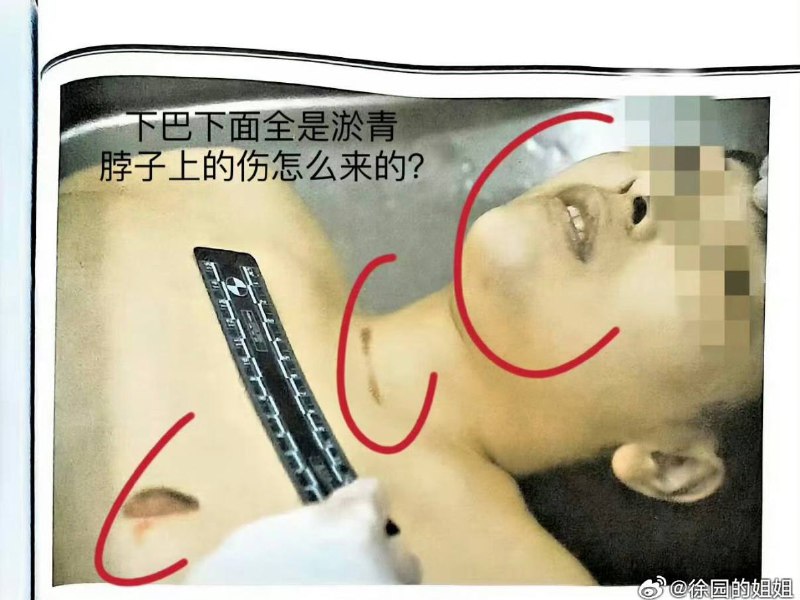 【除夕夜的泣血发声