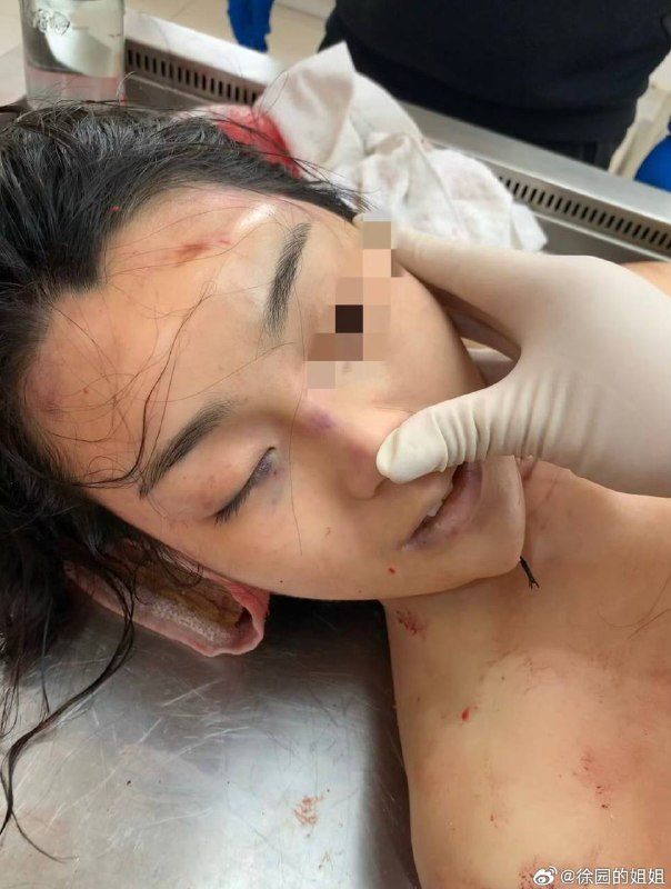 【除夕夜的泣血发声