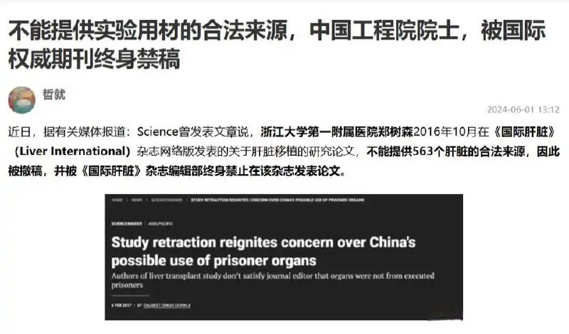 哪来的器官？