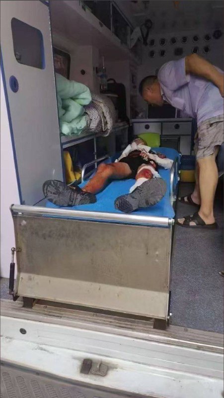 湖南 耒阳 发生一起故意伤害案，致2死3伤，嫌犯被抓获警方通报刀仔捅人报复社会湖南 耒阳 发生一起故意伤害案，致2死3伤，嫌犯被抓获警方通报刀仔捅人报复社会