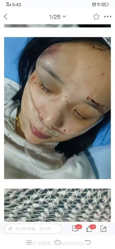 四川江油 霸凌事件因为被霸凌学生父母没有同意协商结果，就出通告了，家长们去政府要说法，当地出动大量特警车，被霸凌者母亲聋哑，父亲不识字，直接引起了公愤…四川江油 霸凌事件因为被霸凌学生父母没有同意协商结果，就出通告了，家长们去政府要说法，当地出动大量特警车，被霸凌者母亲聋哑，父亲不识字，直接引起了公愤…